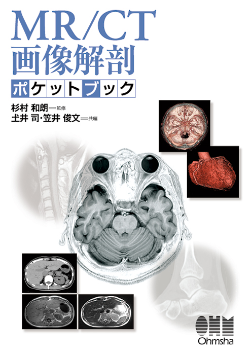 MR/CT画像解剖ポケットブック | Ohmsha