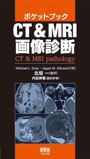 ポケットブック CT＆MRI画像診断