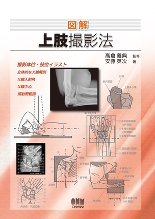 図解　上肢撮影法