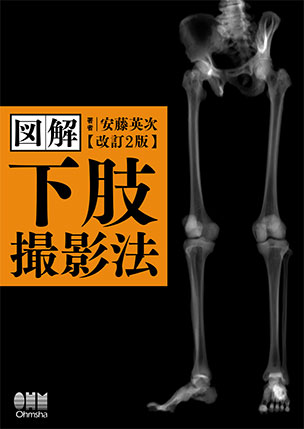 図解　下肢撮影法（改訂2版）