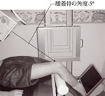 5･30･3　膝蓋骨軸位撮影